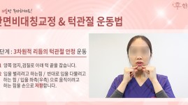 안면비대칭교정방법/ 비대칭운…